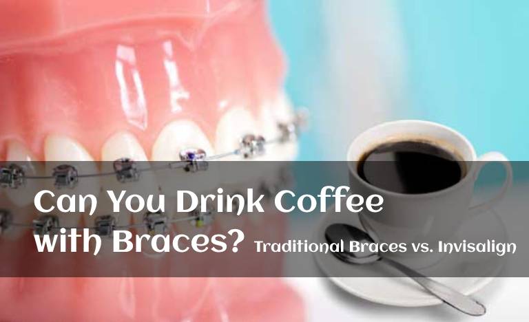 Can You Drink Coffee with Braces